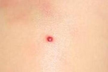 网红朱砂痣,揭秘网红背后的故事与魅力